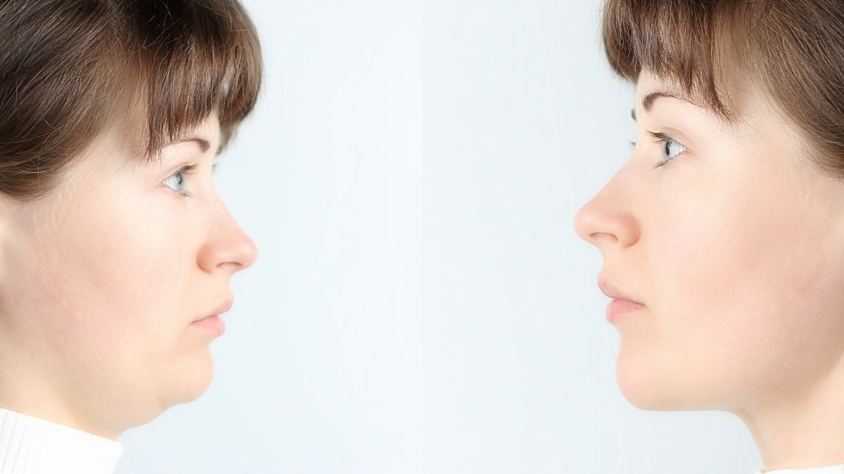 Mujer madura de perfil con la piel luminosa tocando suavemente su mandíbula, en referencia a la firmeza progresiva que se logra con bioestimuladores de colágeno como Sculptra y Radiesse en Medellín