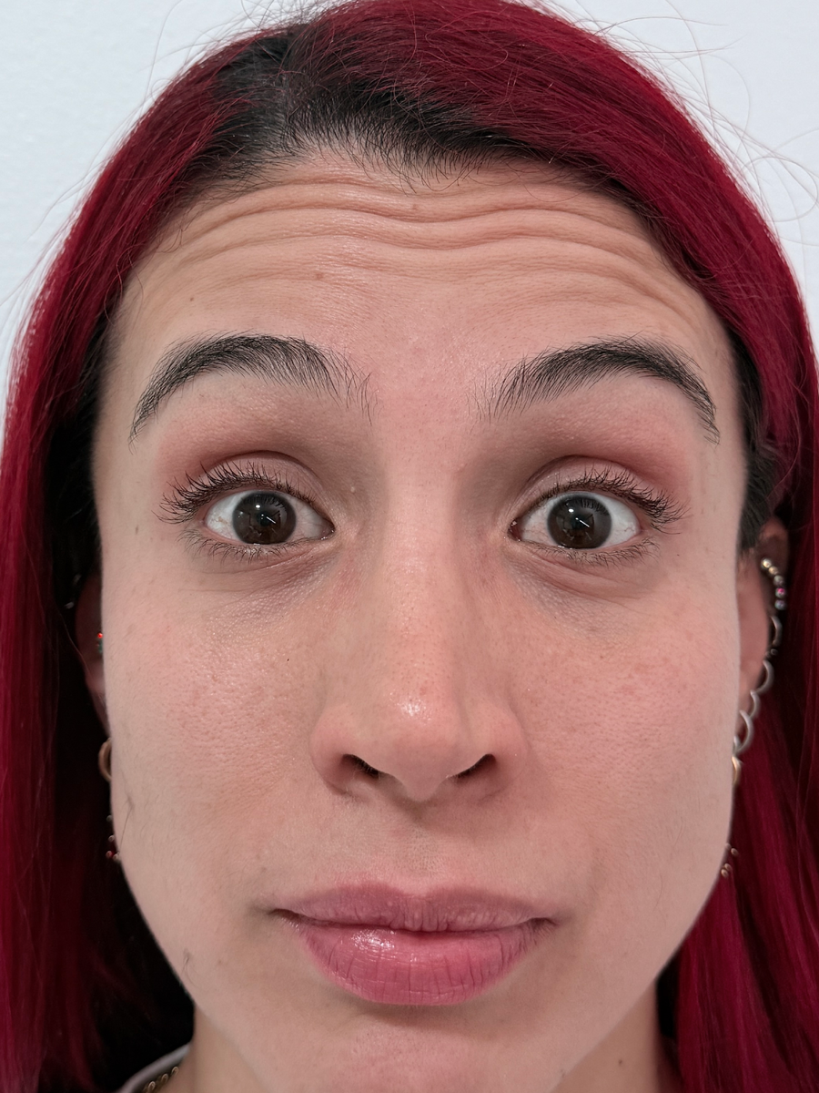 Antes