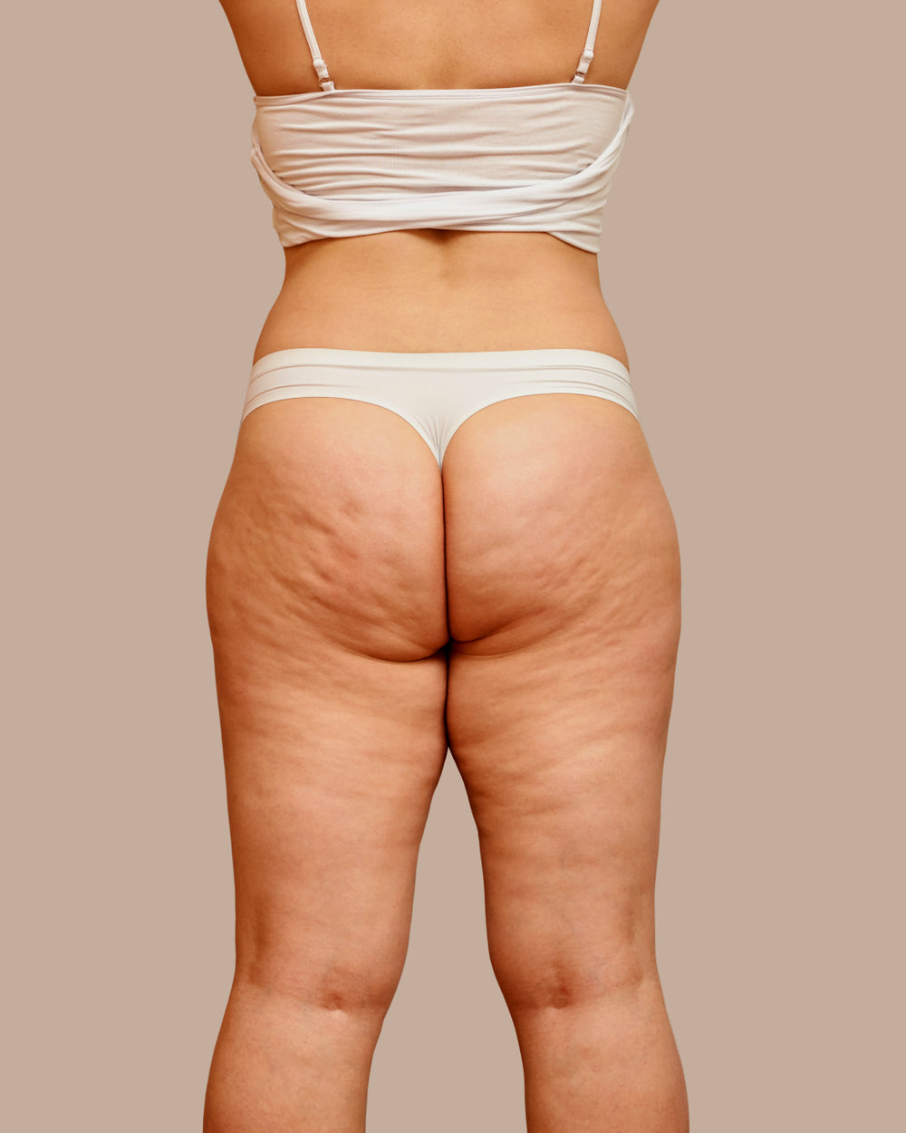 ¿Celulitis, pérdida de firmeza o hip dips?
