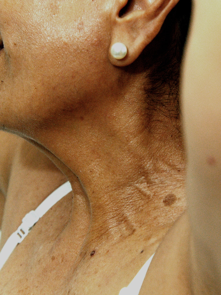 Cuello y escote de una mujer, imagen ilustrativa del tratamiento con bioestimuladores de colágeno para mejorar la firmeza de la piel en Medellín
