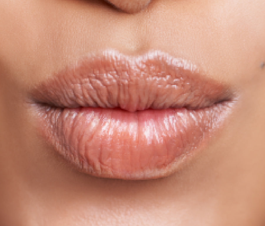 Labios naturales con el labio superior ligeramente evertido, imagen ilustrativa de lip flip con toxina botulínica, sin relleno, en Medellín