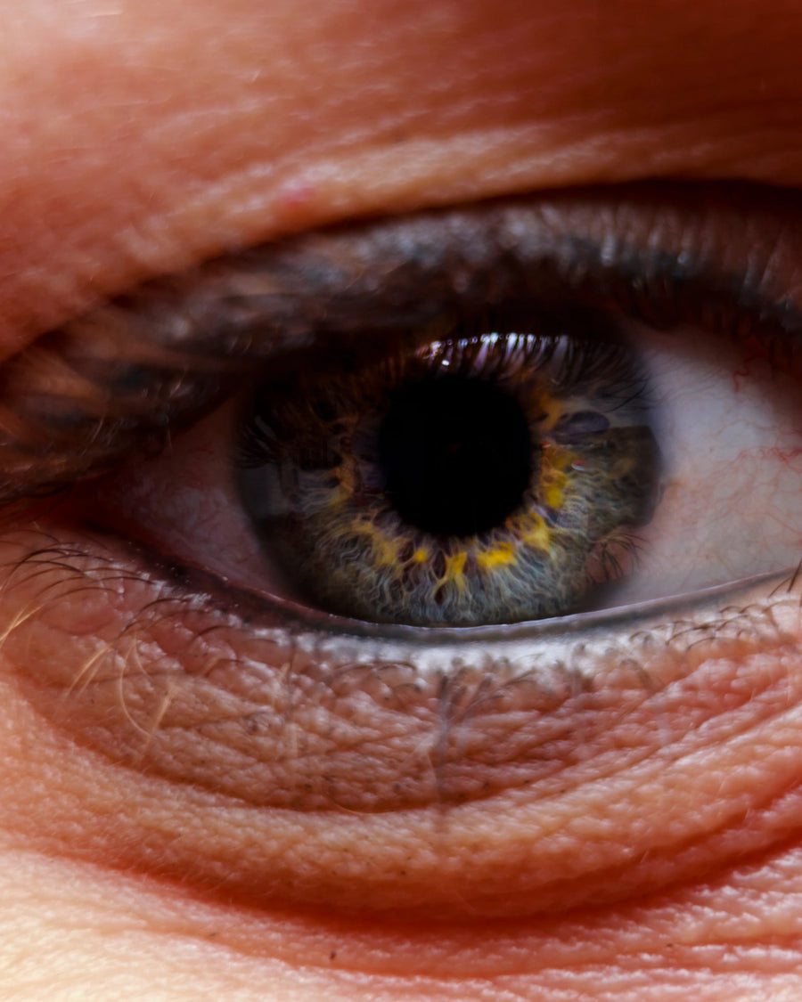 Primer plano de un ojo y la piel del contorno de ojos, imagen ilustrativa del tratamiento de ojeras en Medellín