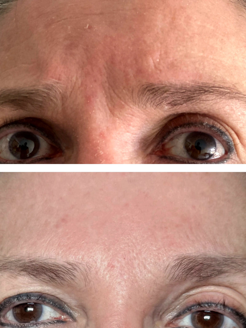 Luminosidad e hidratación · skinboosters