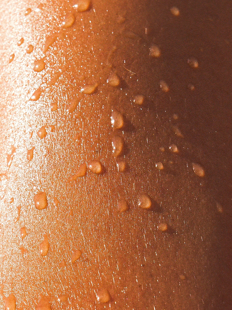 Excessive sweating (hyperhidrosis)