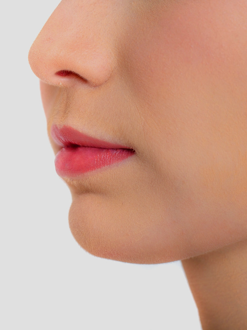 Chin (orange-peel chin)